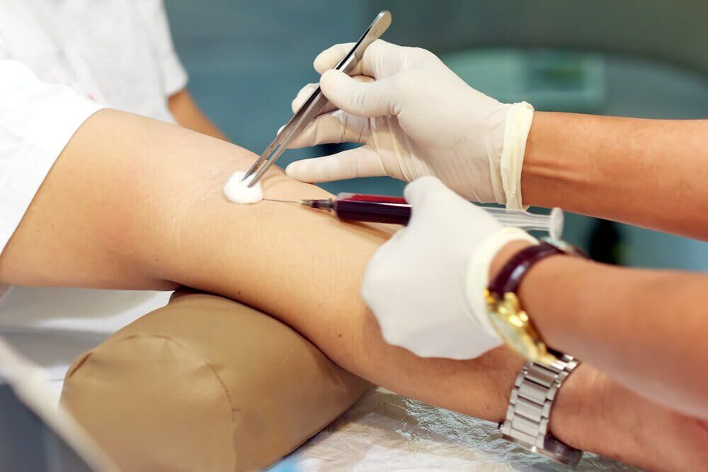 Prp injection contraindications 1 PRP Injection Contraindications