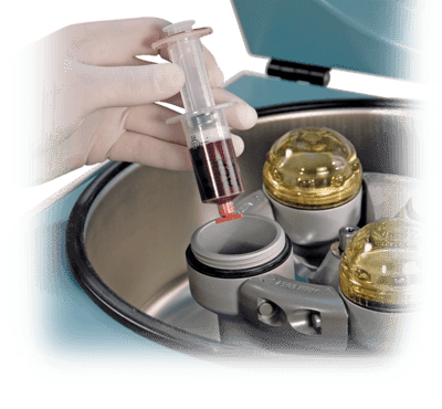 PRP Kit Prices | Platelet Rich Plasma Kit | PRP Injection MD