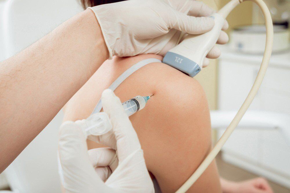 How long is the recovery from prp shot 1 Recovery From PRP Shot Image