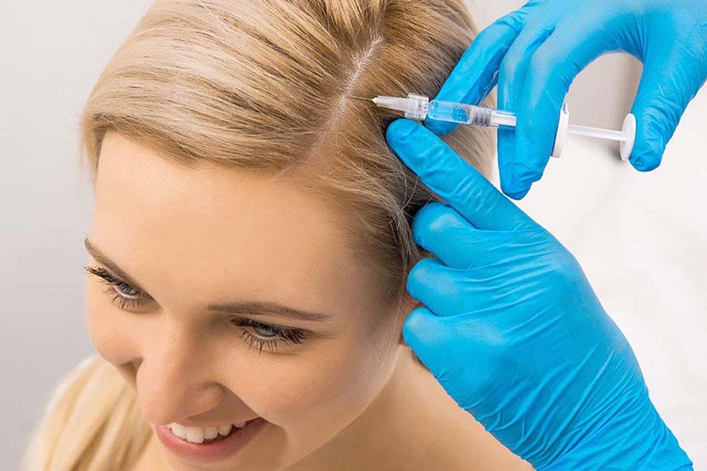 Prp injection for hair loss side effects 1 prp-injection-for-hair-loss-side-effects